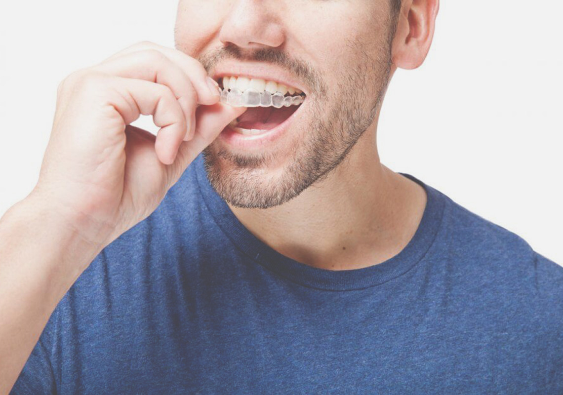 odontoiatria eta adolescenziale