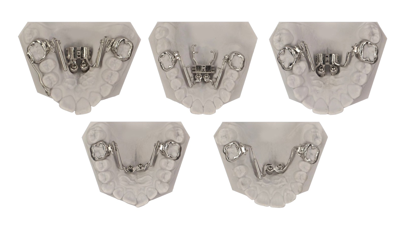 Ortodonzia Pediatrica