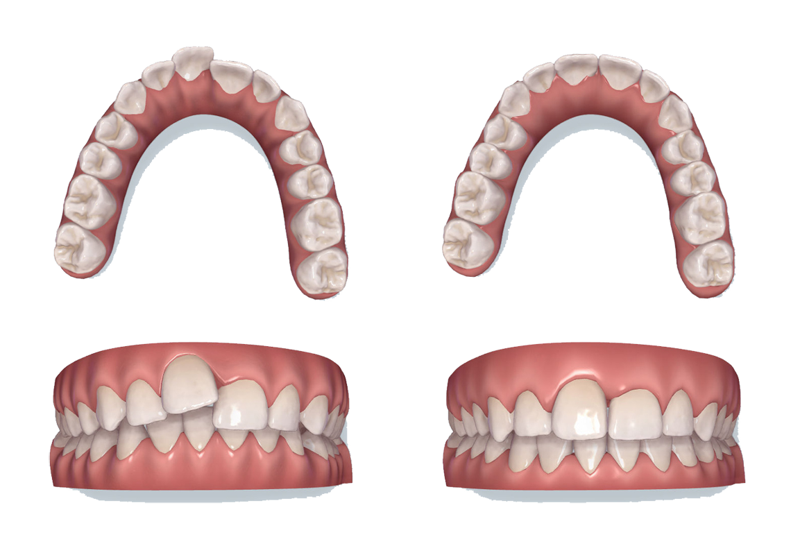odontoiatria eta adolescenziale